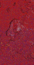     NOAA 18 