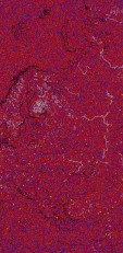     NOAA 18 