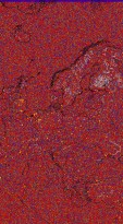     NOAA 18 