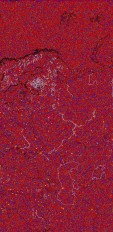     NOAA 18 