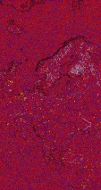     NOAA 18 