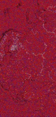     NOAA 18 
