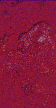     NOAA 18 