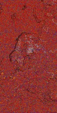     NOAA 18 