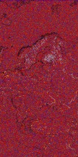     NOAA 18 