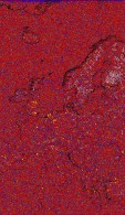     NOAA 18 