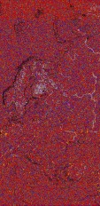     NOAA 18 